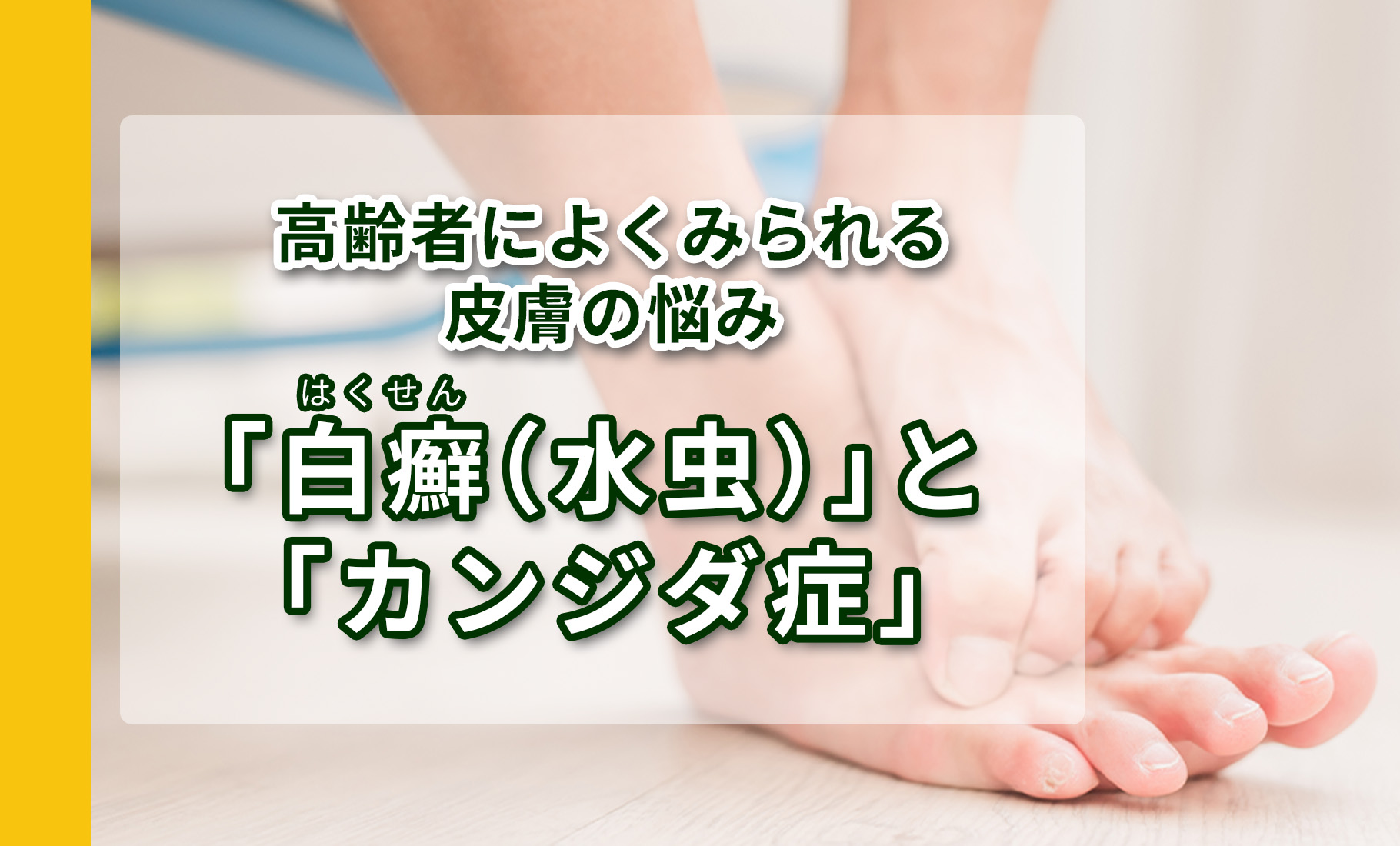 高齢者によくみられる皮膚の悩み：「白癬（水虫）」と「カンジダ症」
