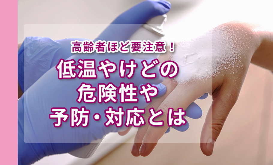 高齢者ほど要注意！低温やけどの危険性や予防・対応とは