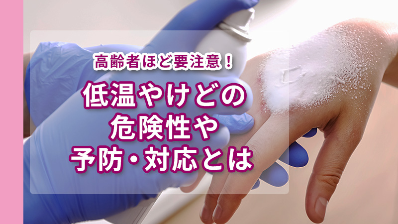 スプレーで手を冷やす人