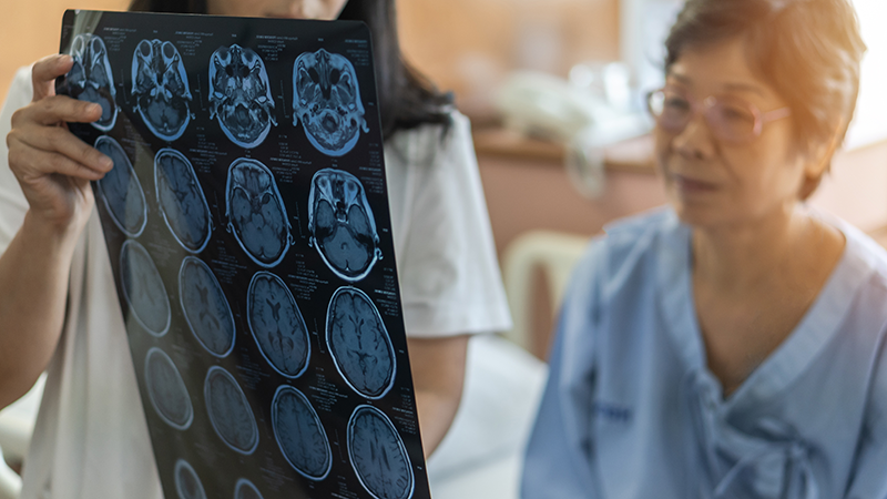 脳の画像診断を聞いている高齢者女性