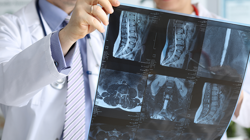 レントゲン写真を見る医者